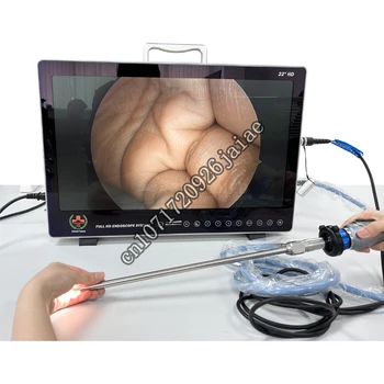 SY-PS050 22/24-дюймовый Медицинский Интегрированный Эндоскоп Full HD CMOS для ЛОР/Лапароскопии/Гистероскопии /урологии